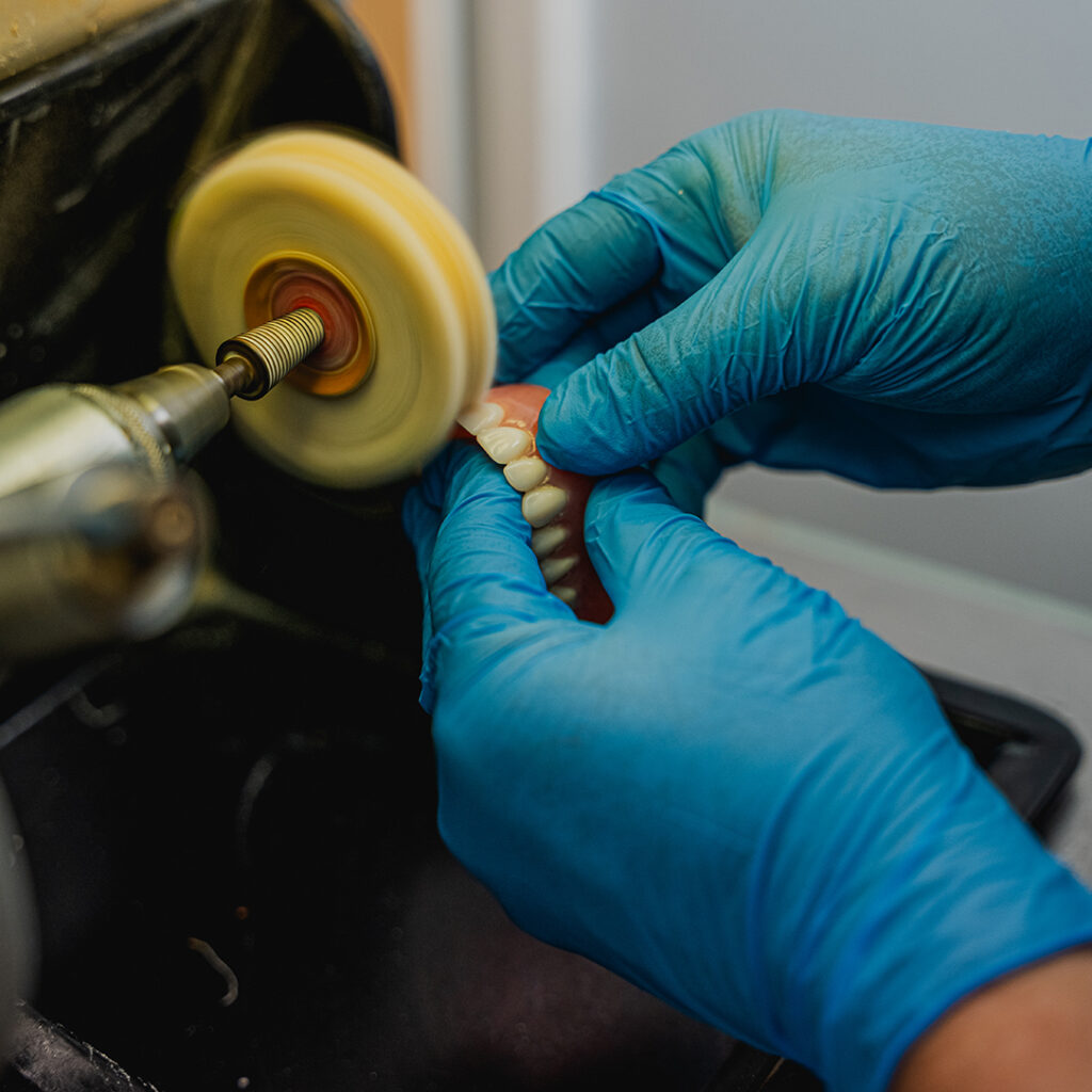 Indistinguishable hands in blue latex gloves using the in-facility lab to finish a denture model for a patient.