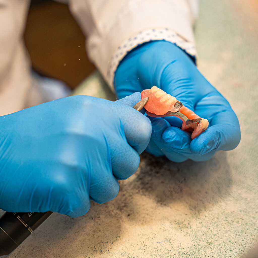 Undistinguishable hands refining a partial denture using hand tools