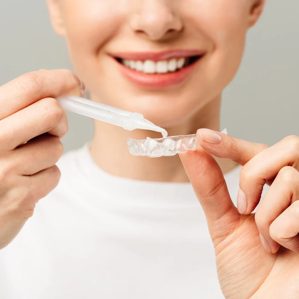 Teeth whitening serum being applied into a clear retainer-style tray using a syringe.