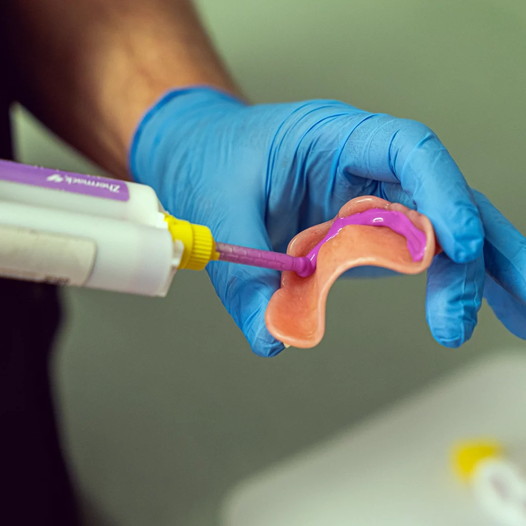 Michael Battell's hand applying pink denture adhesive to a pair of dentures, while wearing blue latex gloves.