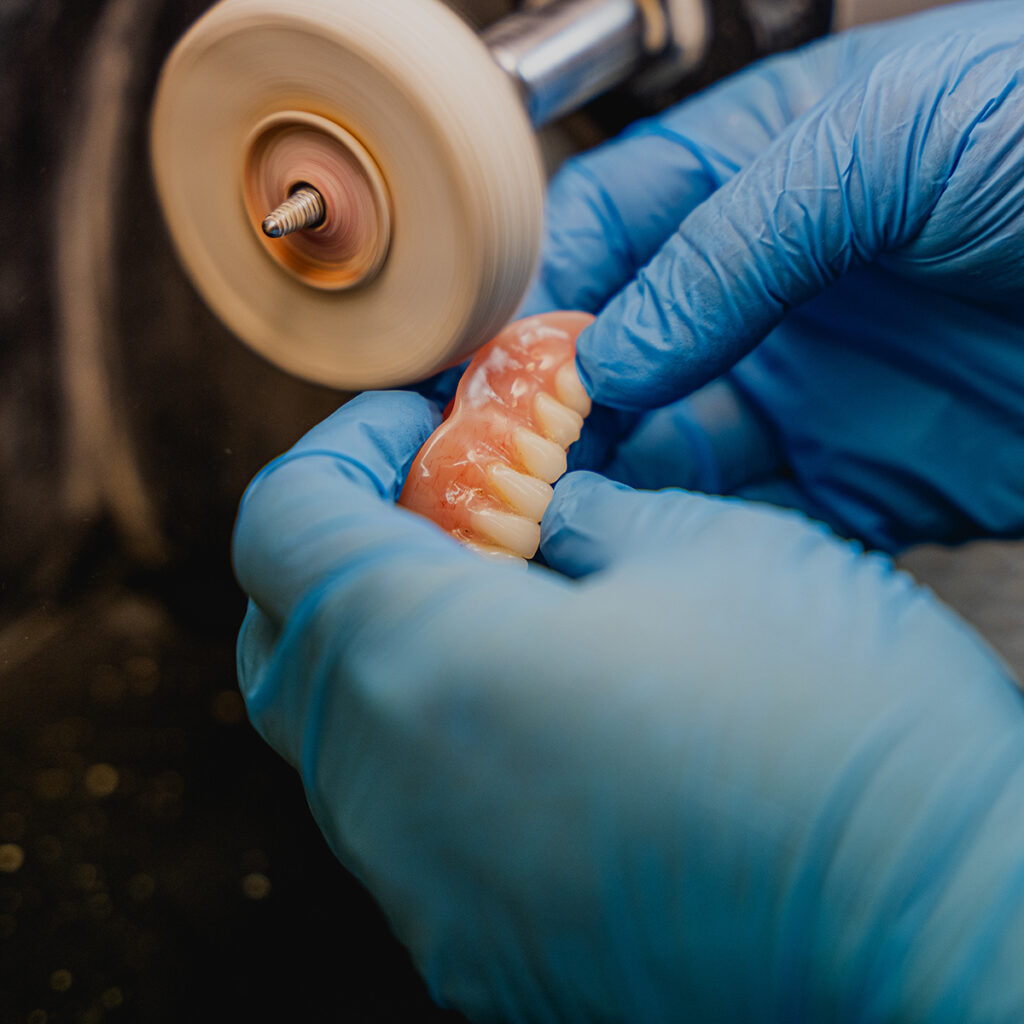 Indistinguishable hands in blue latex gloves using the in-facility lab to finish a denture model for a patient.