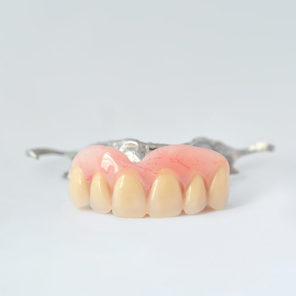Close-up product shot of a partial denture made at Battell Denture Clinic