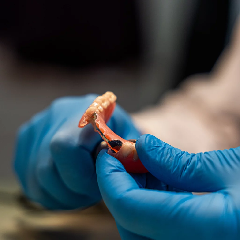 Indistinguishable man wearing clear latex gloves, hand crafting a partial denture model.